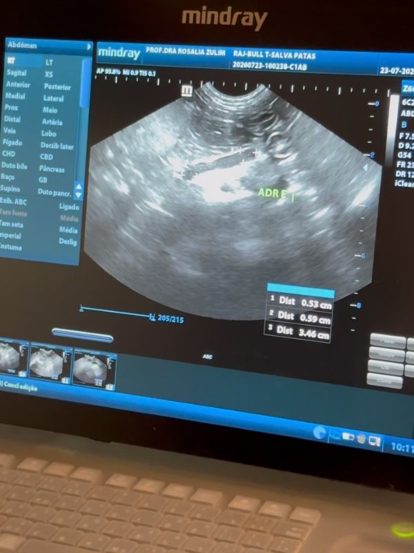 Tela do ultrassom durante exame no consultório